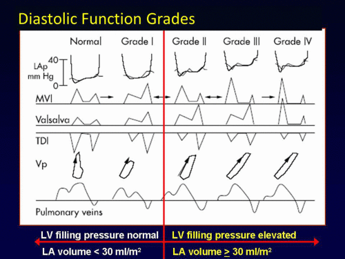 Understanding the Basics: LV Filling Patterns Cardioserv